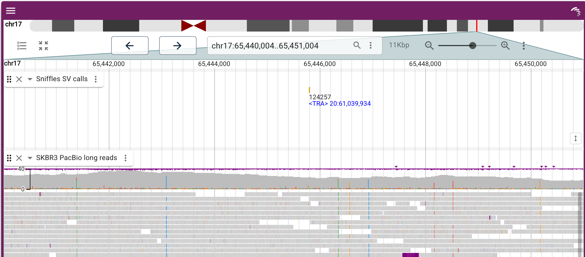 SKBR3 long-read structural variants